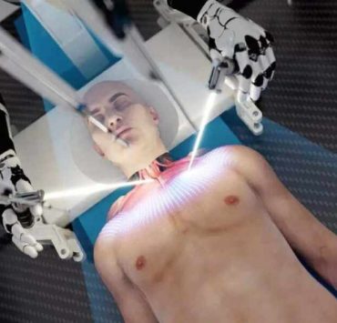 Planean trasplantar una cabeza completa