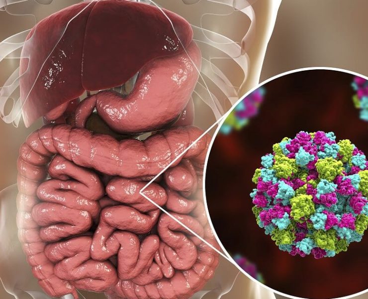 Aumentan casos de gastroenteritis ante temporada de calor en Veracruz