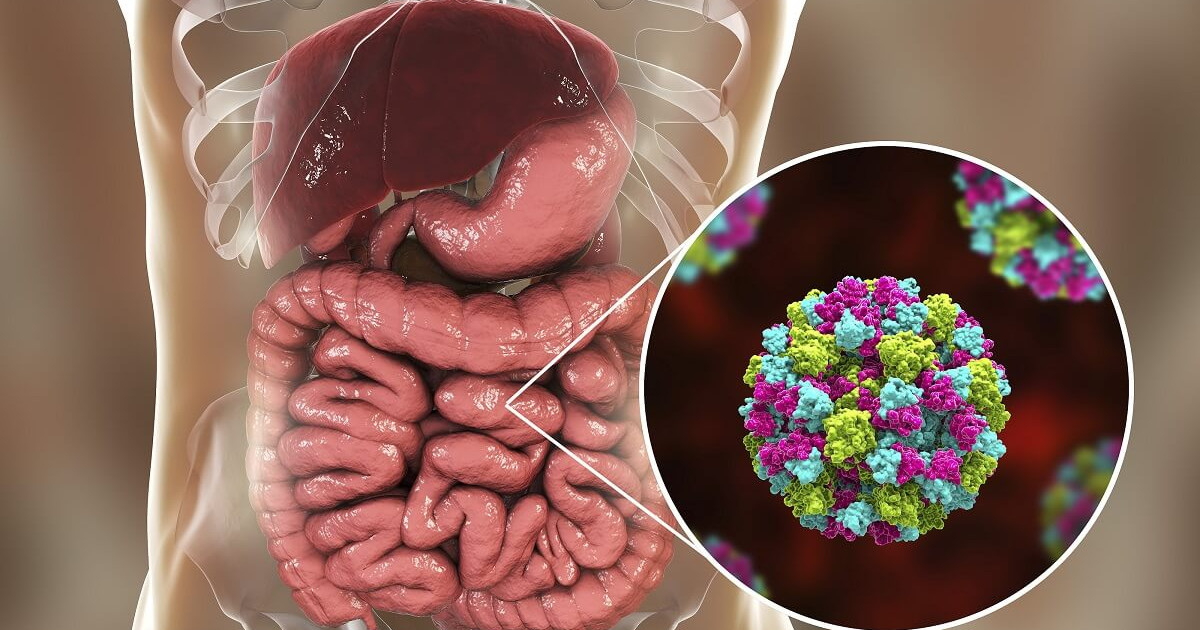 Aumentan casos de gastroenteritis ante temporada de calor en Veracruz